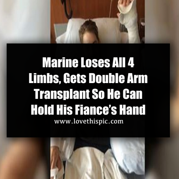 Marine Loses All 4 Limbs, Gets Double Arm Transplant So He Can Hold His Fiance’s Hand