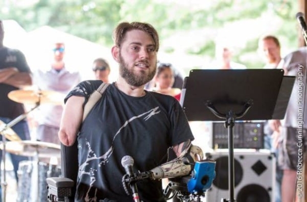 Marine Loses All 4 Limbs, Gets Double Arm Transplant So He Can Hold His Fiance’s Hand - picture 4