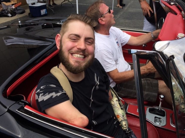Marine Loses All 4 Limbs, Gets Double Arm Transplant So He Can Hold His Fiance’s Hand - picture 5