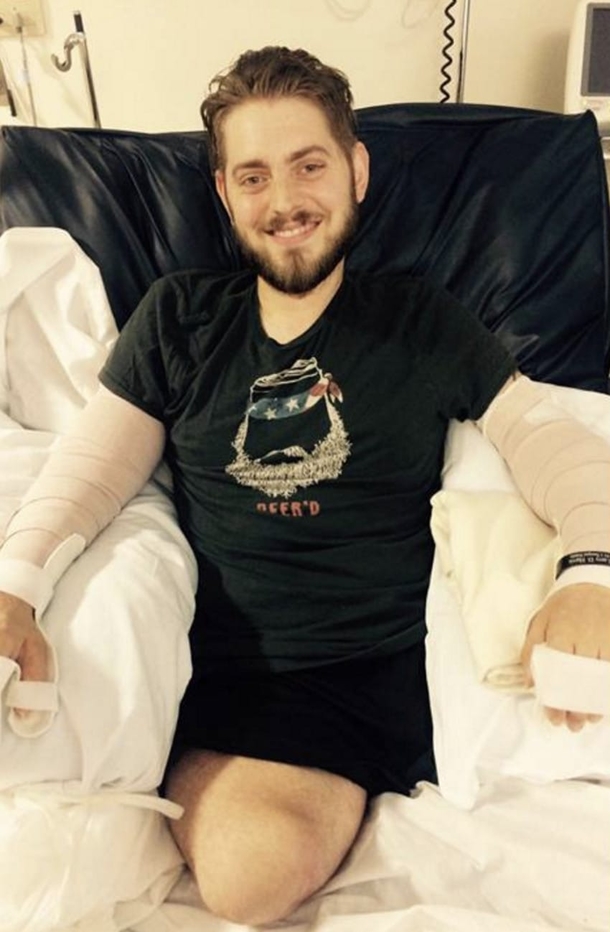 Marine Loses All 4 Limbs, Gets Double Arm Transplant So He Can Hold His Fiance’s Hand - picture 6