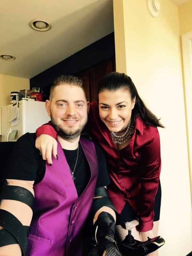 Marine Loses All 4 Limbs, Gets Double Arm Transplant So He Can Hold His Fiance’s Hand - picture 7