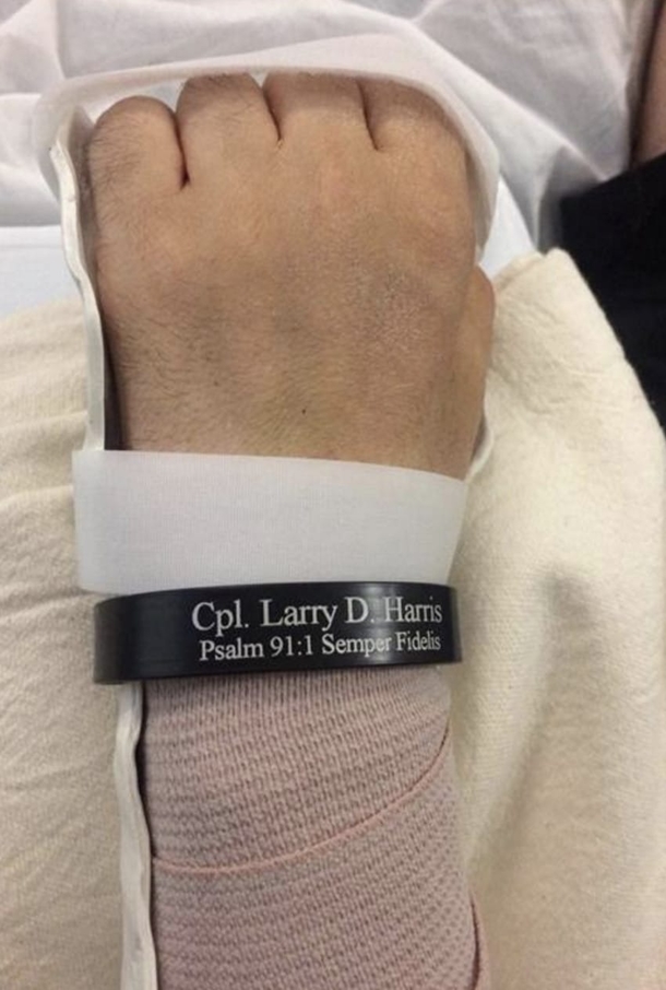 Marine Loses All 4 Limbs, Gets Double Arm Transplant So He Can Hold His Fiance’s Hand - picture 8