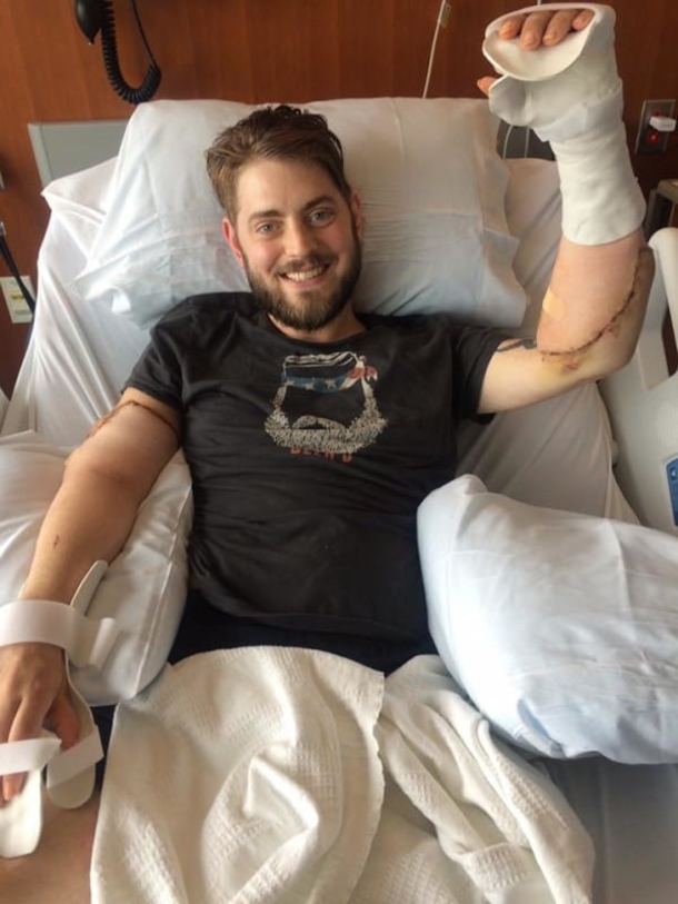 Marine Loses All 4 Limbs, Gets Double Arm Transplant So He Can Hold His Fiance’s Hand - picture 9
