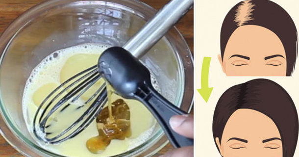 Mix These 3 Ingredients To Regrow Thick, Strong Hair In No Time! - picture 2