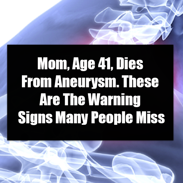 Mom, Age 41, Dies From Aneurysm. These Are The Warning Signs Many People Miss