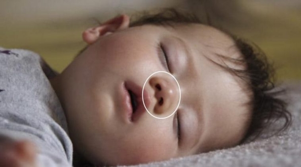 Mom Applies This Remedy To Her Baby, Shortly After He Dies. Be Careful With This, Moms! - picture 3