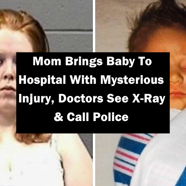 Mom Brings Baby To Hospital With Mysterious Injury, Doctors See X-Ray & Immediately Call Police