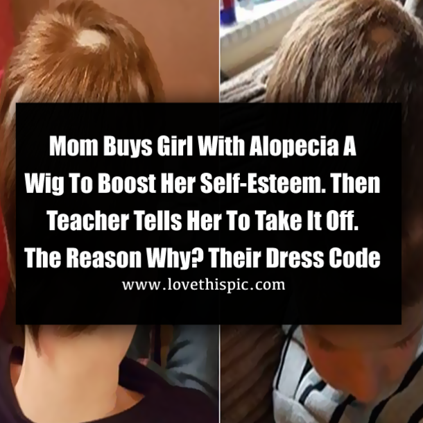 Mom Buys Girl With Alopecia A Wig To Boost Her Self-Esteem. Then Teacher Tells Her To Take It Off. The Reason Why? Their Dress Code