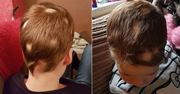 Mom Buys Girl With Alopecia A Wig To Boost Her Self-Esteem. Then Teacher Tells Her To Take It Off. The Reason Why? Their Dress Code - picture 2