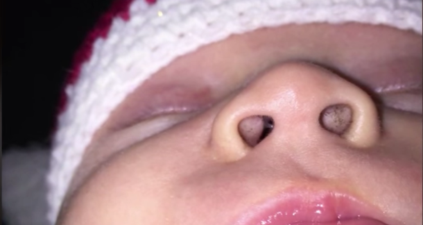 Mom discovers mysterious specks in son’s nose – then discovers the hideous truth - picture 3