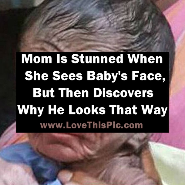 Mom Is Stunned When She Sees Baby's Face, But Then Discovers Why He Looks That Way
