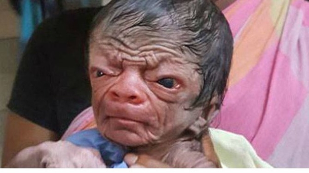 Mom Is Stunned When She Sees Baby's Face, But Then Discovers Why He Looks That Way - picture 2