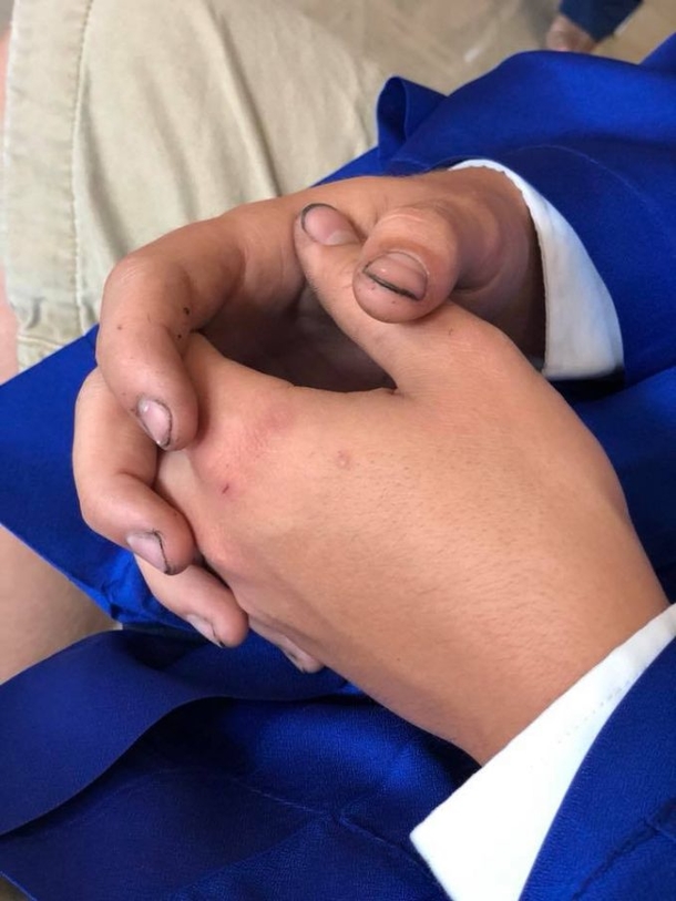 Mom Notices Her Son’s Hands On Picture Day — She Loses It Over Truth He Can’t Hide - picture 4