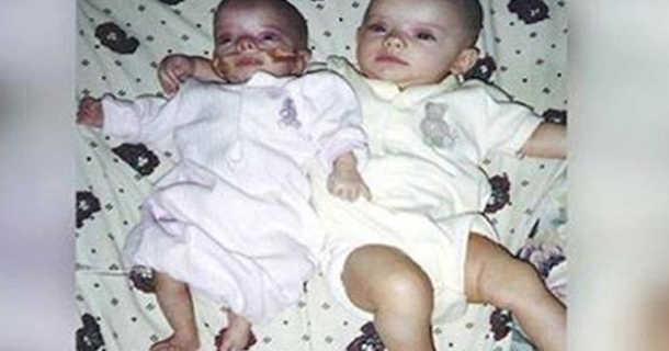Mom Shocked To Finally Learn Why Twins Look Different (Video) - picture 3
