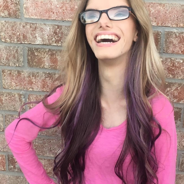 Mom Shocked To Finally Learn Why Twins Look Different (Video) - picture 5