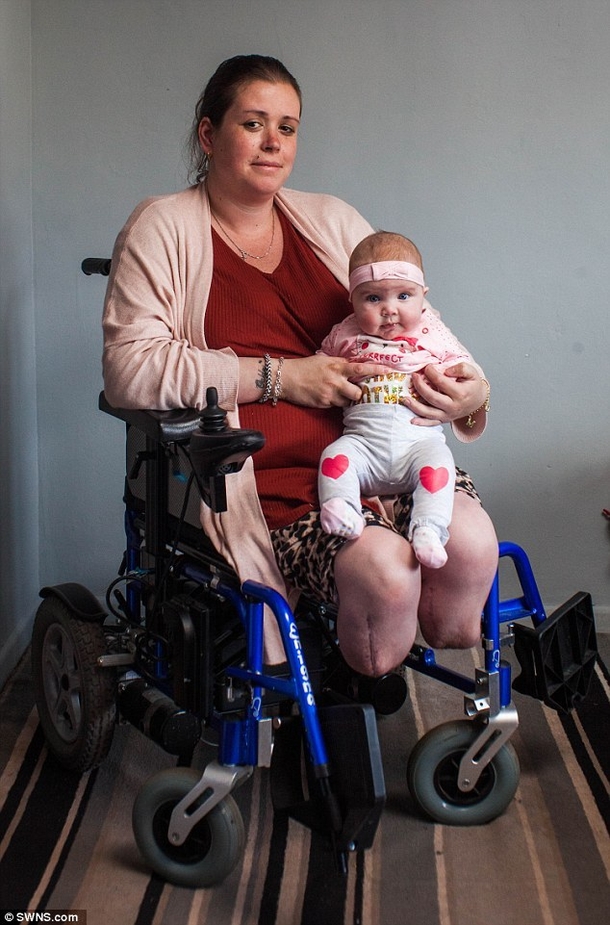Mom Wakes From C-Section, Horrified To Look Down & See What Else Is Missing - picture 4