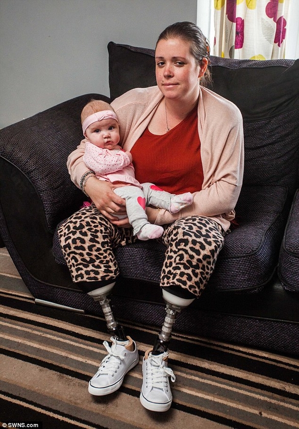 Mom Wakes From C-Section, Horrified To Look Down & See What Else Is Missing - picture 5