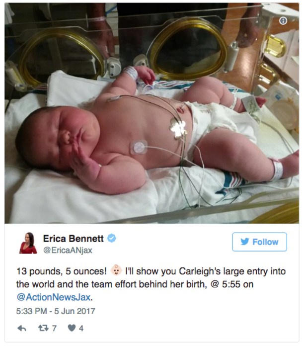 Mom-To-Be Is Stunned By The Size Of Her Belly, But Doctors Are Blown Away On Delivery Day - picture 3
