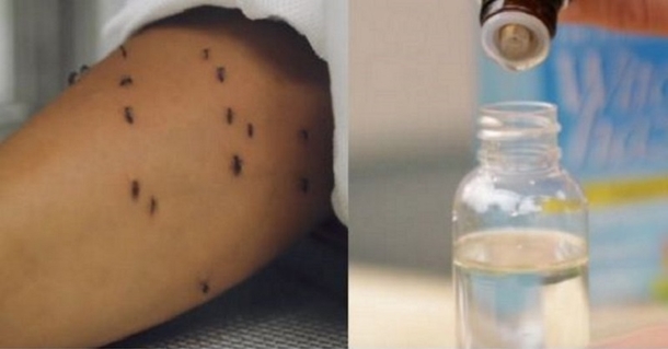 Mosquitoes Won’t Leave You Alone? The 1 Thing Doctors Say Works Better Than Toxic Repellents - picture 2
