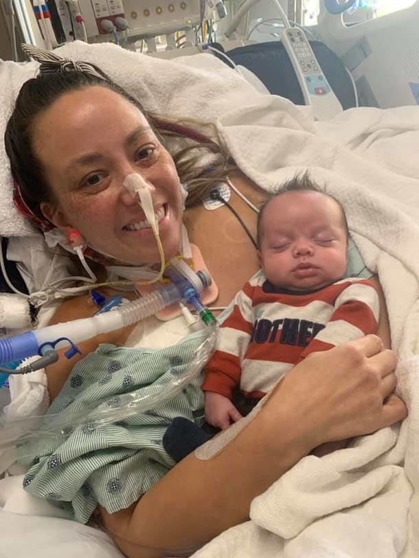 Mother on life support makes incredible recovery, meets her baby after birth while she was on ventilator - picture 3