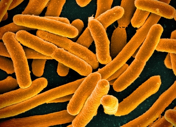 Mysterious Outbreak Spreads Across 5 States; Close To 100 Sickened; Medical Experts Search For Source - picture 5