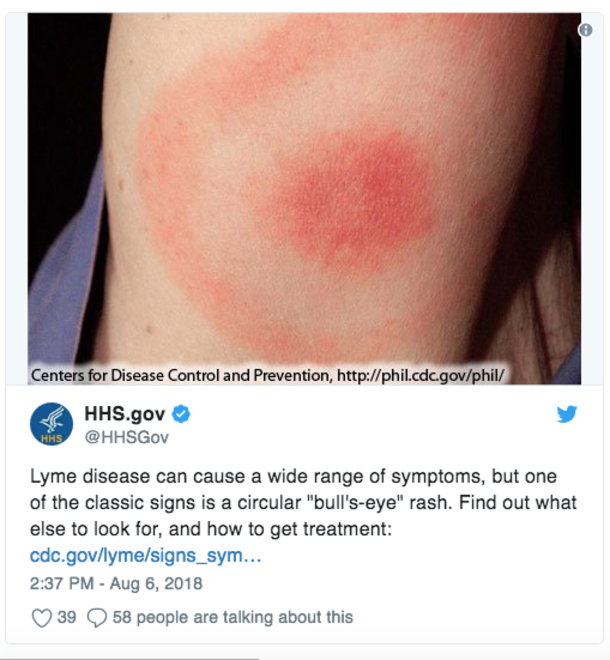 Nationwide Disease Outbreak Attacks All 50 States, Be Sure To Check Your Children For These Symptoms - picture 5