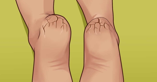Never Worry About Dry And Cracked Or Itchy Feet Again With This Essential Trick - picture 2