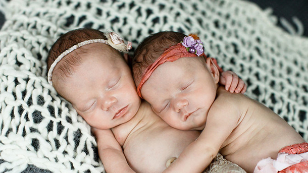 New Mom Hears Doctor Let Out Gasp After Delivery, Quickly Realizes What Happened - picture 2