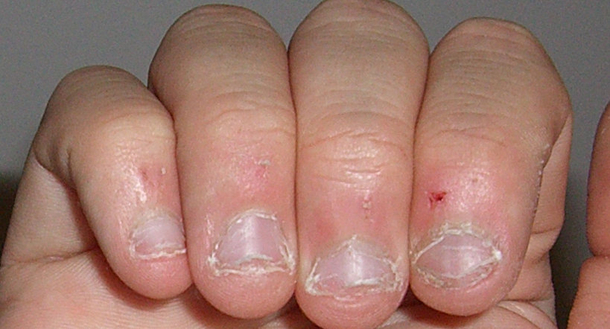 NEW STUDY REVEALS NAIL-BITING ISN’T A NERVOUS HABIT BUT A SIGN OF A PARTICULAR PERSONALITY TYPE - picture 2