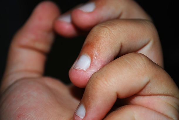 NEW STUDY REVEALS NAIL-BITING ISN’T A NERVOUS HABIT BUT A SIGN OF A PARTICULAR PERSONALITY TYPE - picture 3