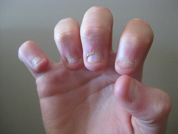 NEW STUDY REVEALS NAIL-BITING ISN’T A NERVOUS HABIT BUT A SIGN OF A PARTICULAR PERSONALITY TYPE - picture 4