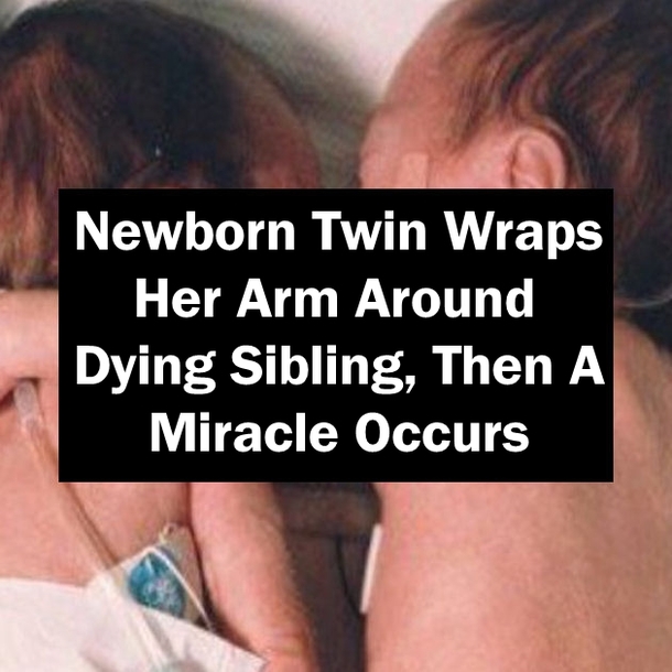 Newborn Twin Wraps Her Arm Around Dying Sibling, Then A Miracle Occurs
