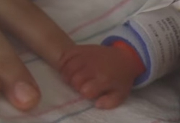 Newborn Twin Wraps Her Arm Around Dying Sibling, Then A Miracle Occurs - picture 3