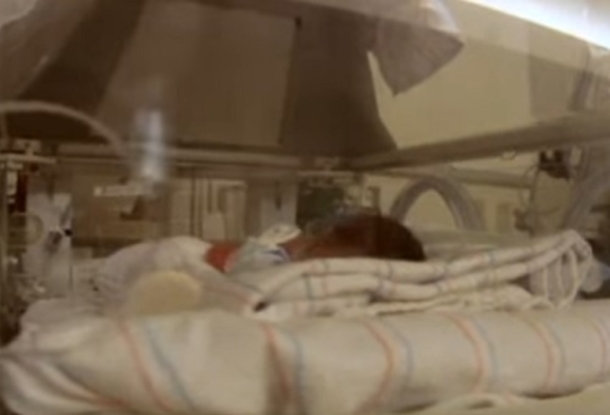 Newborn Twin Wraps Her Arm Around Dying Sibling, Then A Miracle Occurs - picture 4