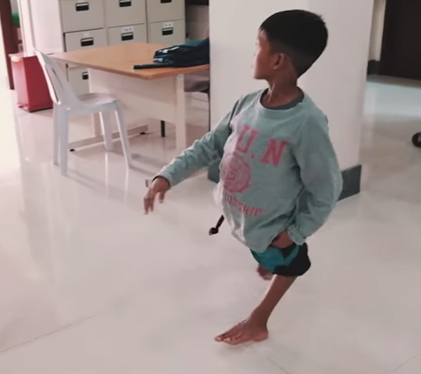 NFL Star Tim Tebow Uses His Faith & Heart To Save Boy With "Flamingo Legs" - picture 4