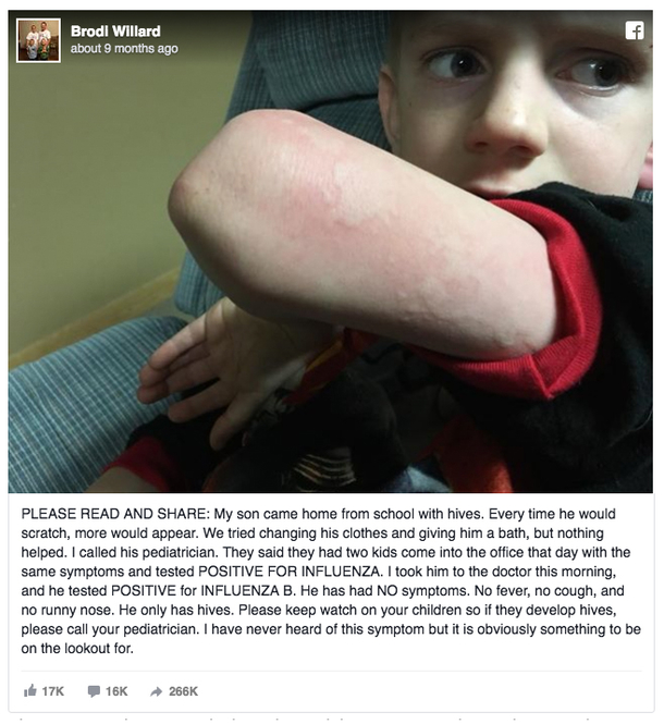Nurse’s son catches the flu only days after showing this strange symptom – we all need to read this - picture 2