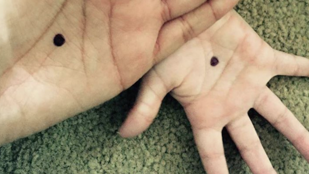 Once Police Saw Her Photo With A Black Dot On Her Hand, They Rushed To Make An Arrest - picture 3