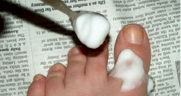 Once She Placed Baking Soda On Her Toes, One Of Life's Most Annoying Problems Was Solved - picture 2