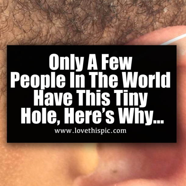 Only A Few People In The World Have This Tiny Hole, Here’s Why…