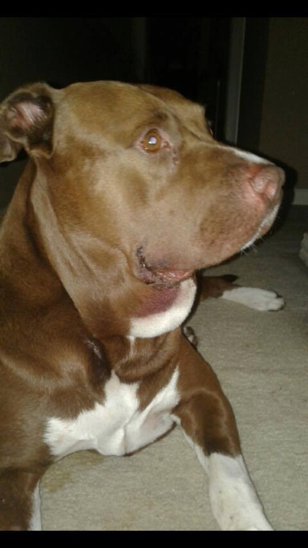 Owner Takes Pit Bull Off Leash, A Loud Scream Erupts Seconds Later And He Takes Off Running - picture 4