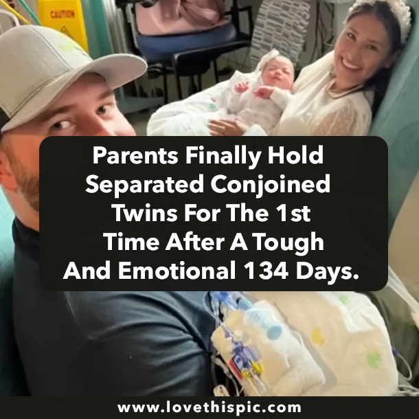 Parents Finally Hold Separated Conjoined Twins For The 1st Time After A Tough And Emotional 134 Days.