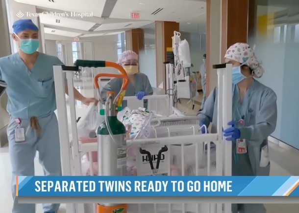 Parents Finally Hold Separated Conjoined Twins For The 1st Time After A Tough And Emotional 134 Days. - picture 3