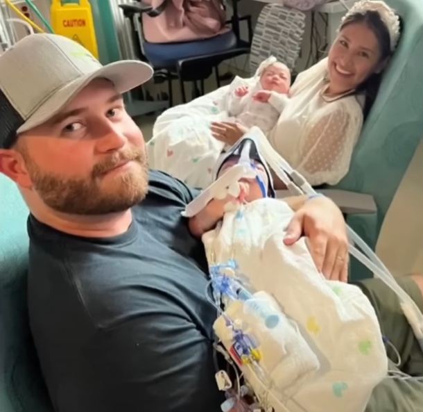 Parents Finally Hold Separated Conjoined Twins For The 1st Time After A Tough And Emotional 134 Days. - picture 4
