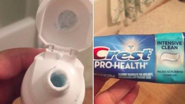 Patient Caught Off Guard When Dentist Suddenly Reaches Into Her Mouth, Pulls Something Out (Photo) - picture 2