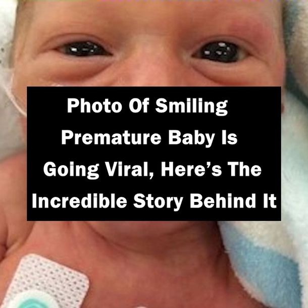 Photo Of Smiling Premature Baby Is Going Viral, Here’s The Incredible Story Behind It
