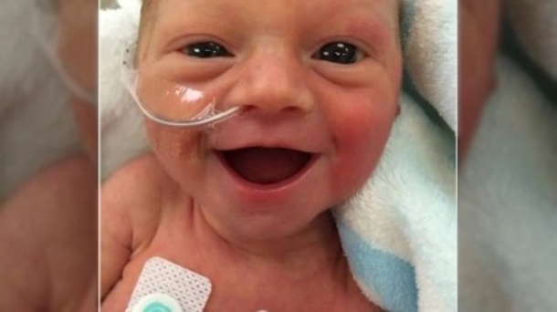 Photo Of Smiling Premature Baby Is Going Viral, Here’s The Incredible Story Behind It - picture 2
