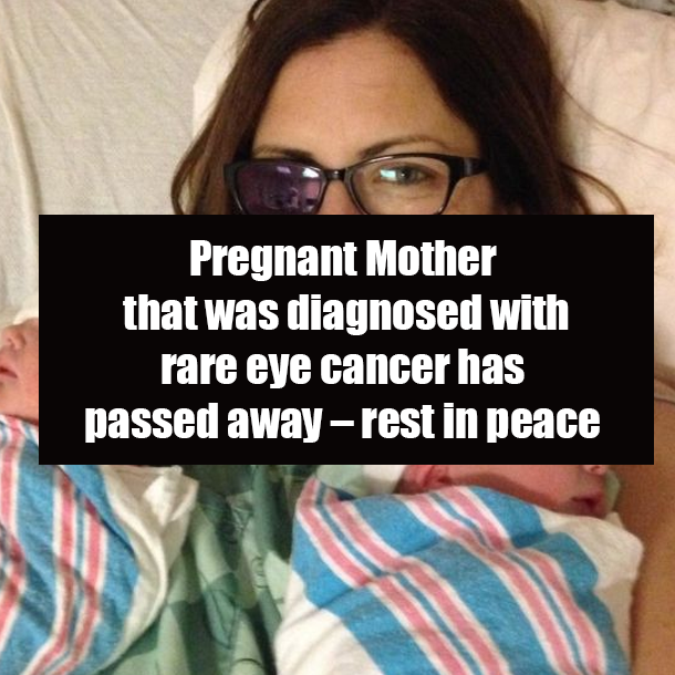 Pregnant Mother that was diagnosed with rare eye cancer has passed away – rest in peace