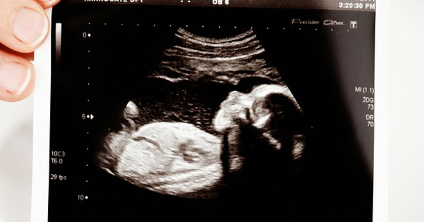 Pregnant Woman Becomes Friends With Someone Online. Then A Box Arrives At Her Home. When She Opens It Up? Wow - picture 2