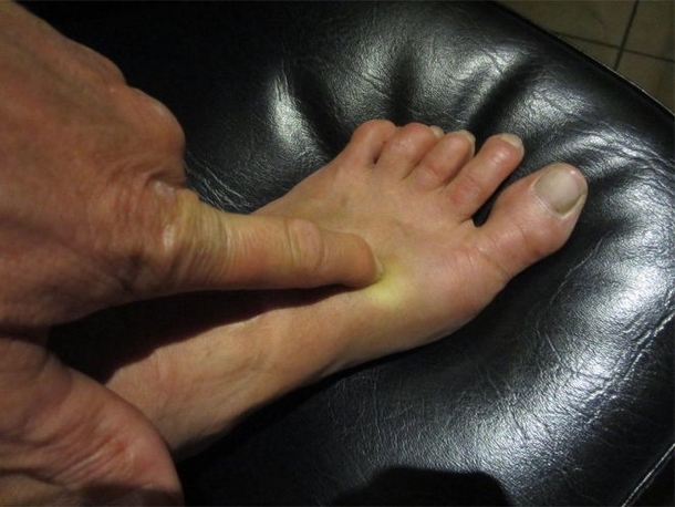 Press This Point On Your Foot Before Bed And You Will Be Amazed By What It Does To Your Body... - picture 2