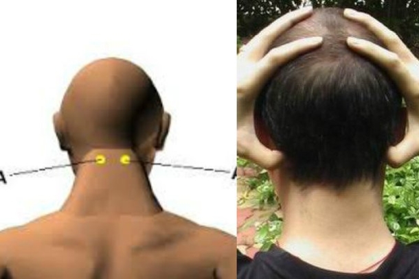 Pressing THESE Points On Your Body, Will Get Rid Of A Headache Immediately Without Medicine! - picture 11